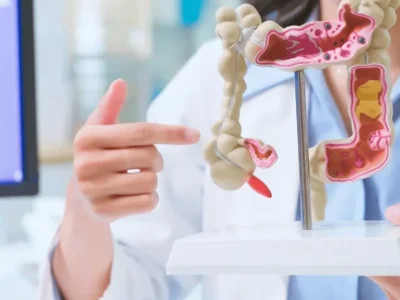 Intestino saudável em 30 dias: hábitos que recuperam a flora